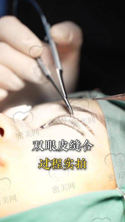 王衡健医生的技术优势在哪？