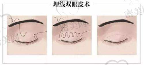 从患者角度分析：王衡健和张诗若，谁更适合你？