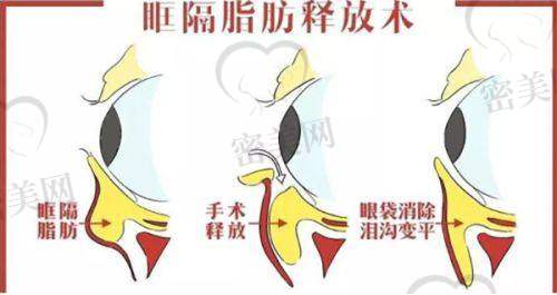 重庆华美紫馨整形医院：开展韩式媚眼术的强大后盾