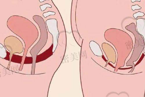淄博卓美医美：等离子“微光刀”技术，全新感受