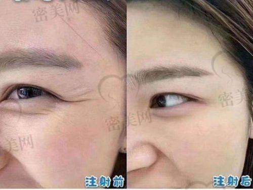 江油莱美尔医疗美容门诊部：江油人气口碑医院
