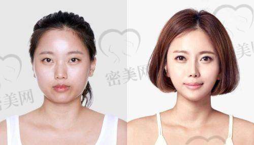 重庆联合丽格：纳米脂肪塑形，年轻化不止于面子