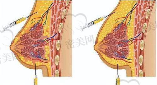 医生团队实力实力强，擅长眼部整形+面部年轻化