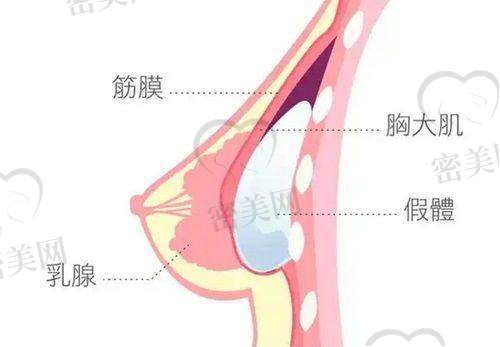 成都米兰柏羽整形医院：耳再造与胸部综合美学代表