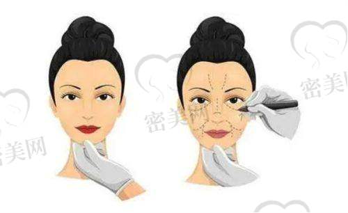 大众评价如何？淄博壹美在当地口碑稳定上升