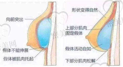 淄博天丽整形医院：专注射频精细化雕刻，修复快见效快