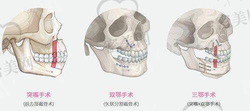 4. 拉萨瑞俪医疗美容门诊部：温馨私密，擅长女性私密项目