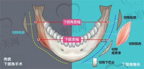 患者手术体验反馈：真实说一说