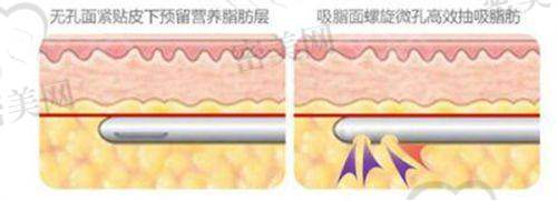 鼻部整形价格表