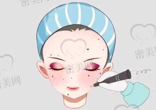 屈光矫正、美肤注射等特色服务一览