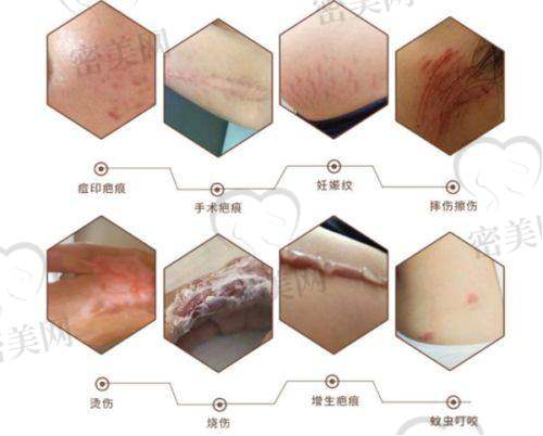 王晓欣医生｜女医生中专精细致代表