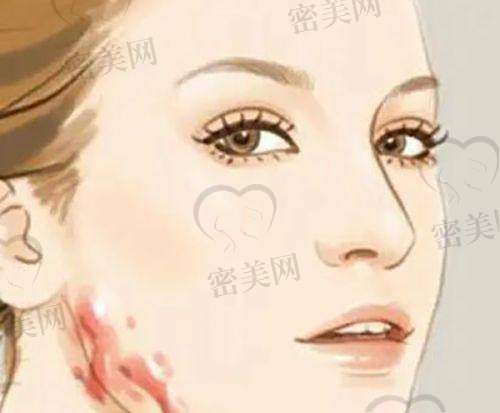成都禾臣瑞亚医美医院：脂肪塑形年轻派专精