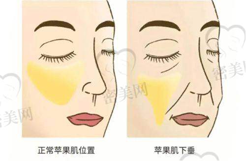 写在选择前的提醒：手术靠谱，观念也得对