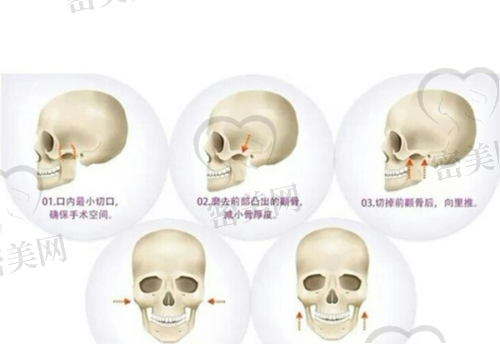 2. 拉萨爱思特医疗美容医院：连锁品牌进驻，规范标准高
