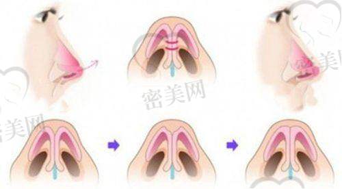 焦恩俊医生｜年轻派技术流