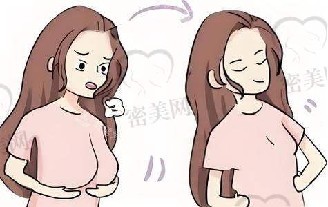 湖南悦好医疗美容医院：复合式方案吸脂同步减码