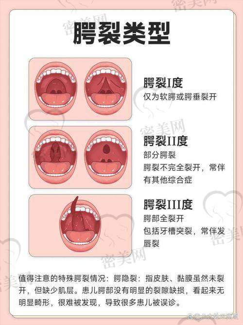 广州高尚余文林医生简介：非网红医生，靠技术圈粉