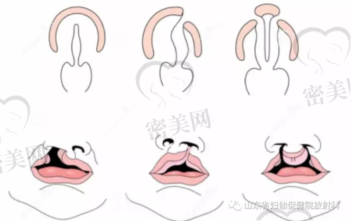 这些情况也能申请补助？你可能被“误会”了