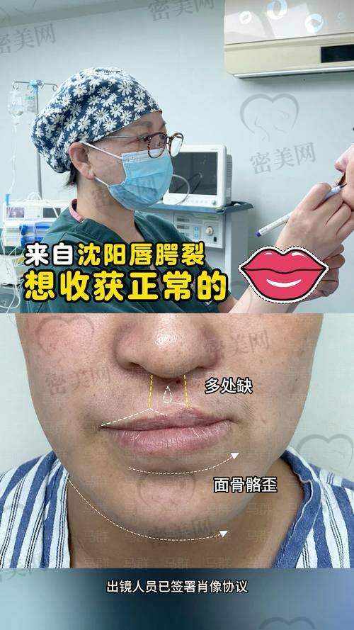 挂号指南：如何快速联系余文林医生，预约唇裂/耳畸形修复面诊