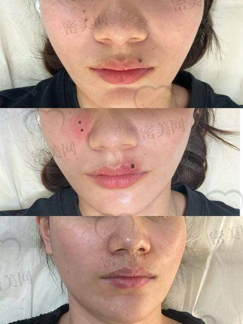 昆山丽馨医疗美容