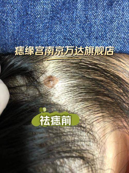 价格到底多少？来看这张来自正规三等甲医院的费用区间表