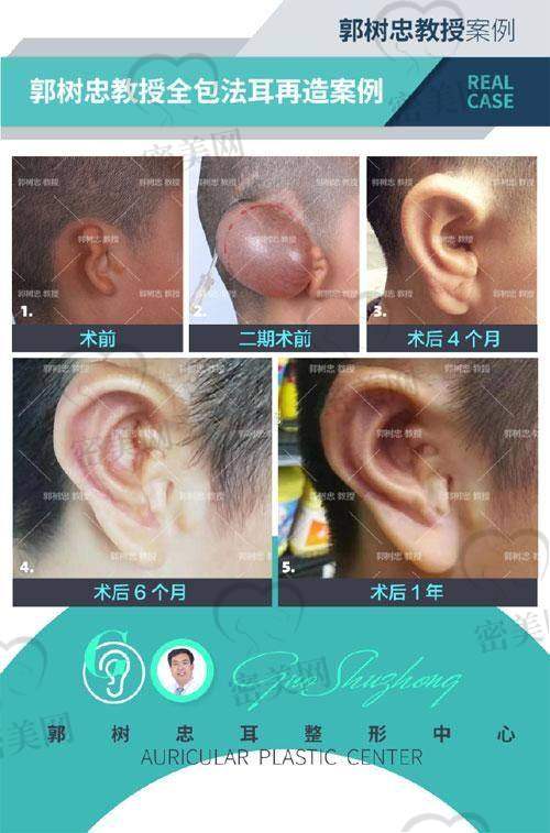 医生不是“包装”出来的，实打实术例成就口碑