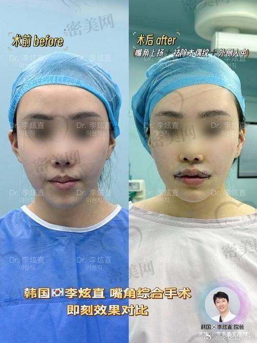 深圳福雅医疗美容医院价格是否透明？真实用户反馈来了