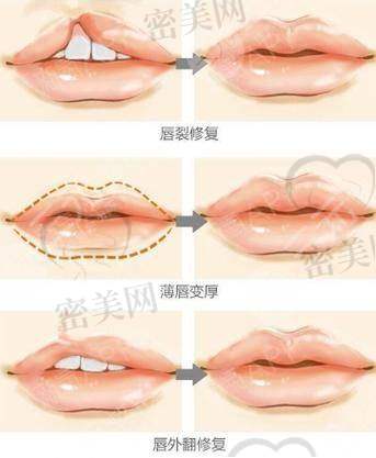 深圳福雅医疗美容医院有哪些热门特色项目？从精致面部到火辣S曲线