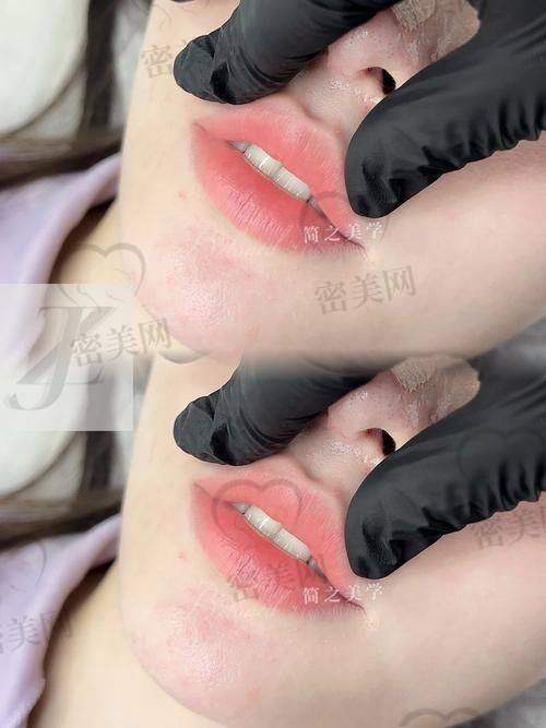 重庆当代整形外科医院王旭明的真人实例：见证奇迹时刻