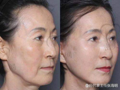 4. 北京一加一医疗美容门诊部