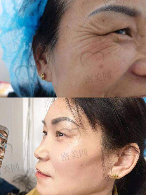 关于价格：不同方案不同定价，价格透明