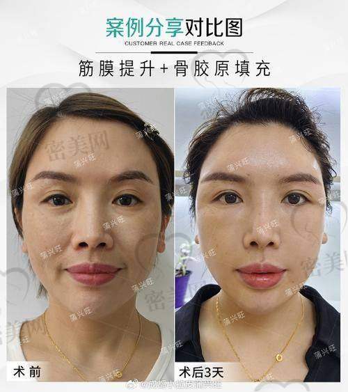 1. 北京润美玉之光医疗美容