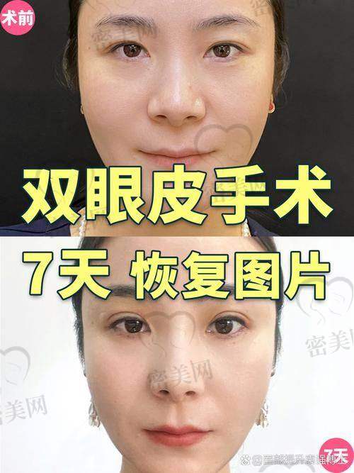 术后修复细节管理：成效稳稳的才是硬道理
