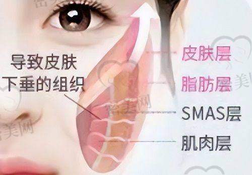 如何判断你是否适合来找陈凤超手术？