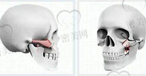 成都纯曦医疗美容医院：唇眼专精细化雕刻塑艺术殿堂