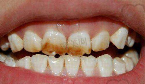 【重庆泰康拜博口腔九龙坡门诊部诊疗设备:】