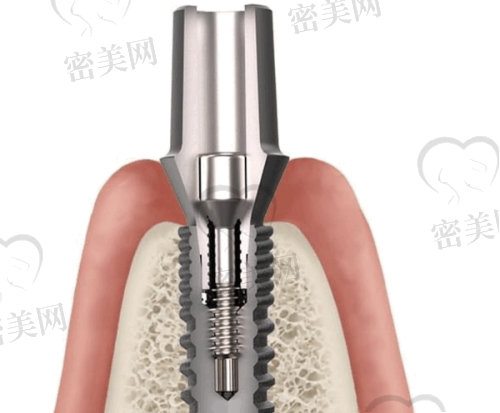 【重庆牙益美口腔诊所特色项目：】