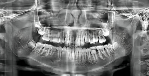 【重庆泰康拜博口腔九龙坡门诊部特色项目:】