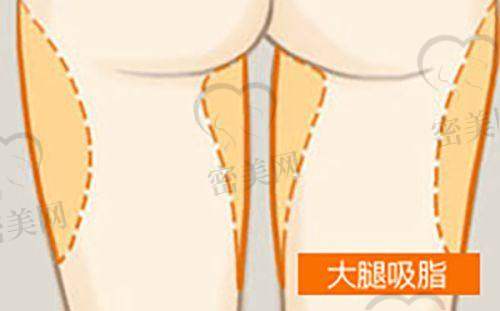 常见项目成效及建议周期
