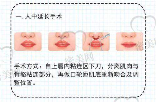 深圳阳光整形医院：苏兴医生主打自然感唇形构建