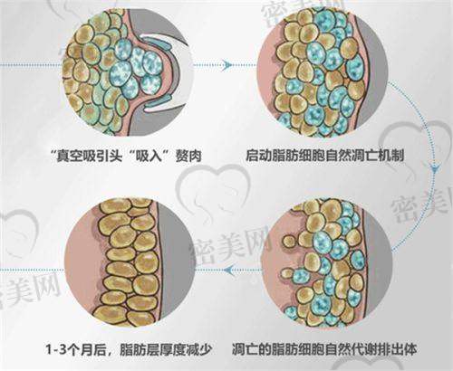 服务体验再升级，打造“美丽+安心”的整形环境