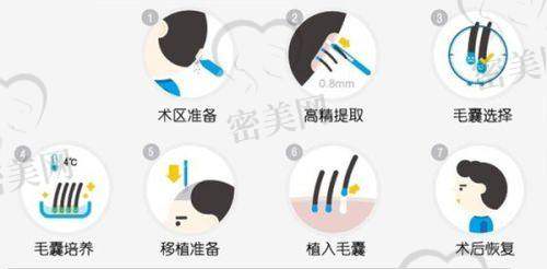 深圳倍生植发怎么预约挂号？
