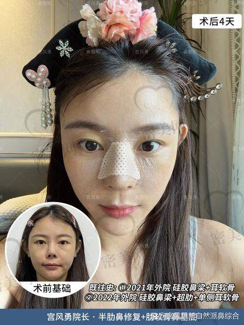 真实实例对比图曝光：术前术后差别大吗？