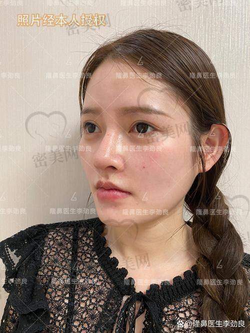 深圳壹加壹医学美容 | 东南亚审美派代表，年轻人钟爱的平价实力派