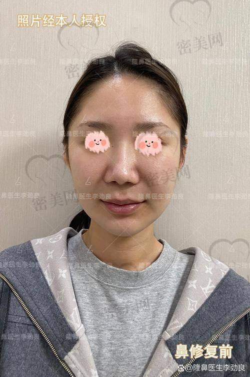 王天国医生口碑为何能在深圳稳居前列？
