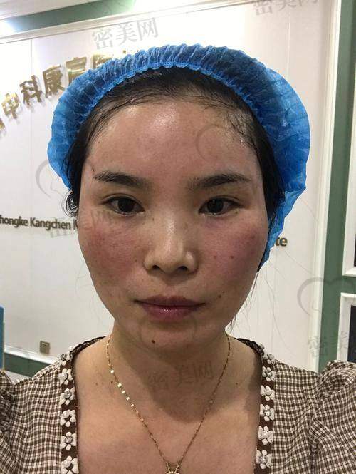 你适合哪种方案？从这些细节做决定