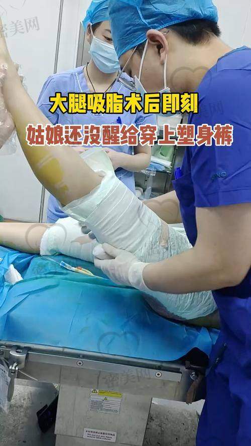 真人实例：6800 元美腿逆袭大变身