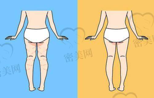 重庆华美紫馨：美腿梦想的豪华宫殿