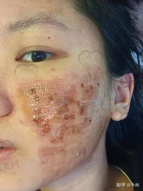 西安叶子医疗美容医院