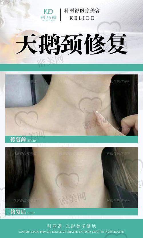 网友真实反馈：成效好不好不能只看照片